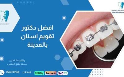 افضل دكتور تقويم اسنان بالمدينة