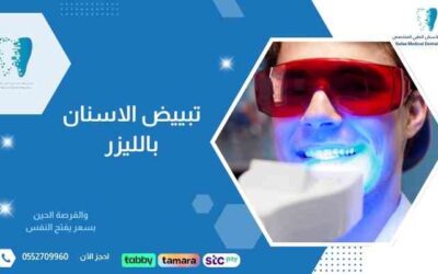 تبييض الاسنان بالليزر