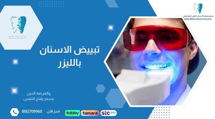 تبييض-الاسنان-بالليزر تبييض-الاسنان-بالليزر