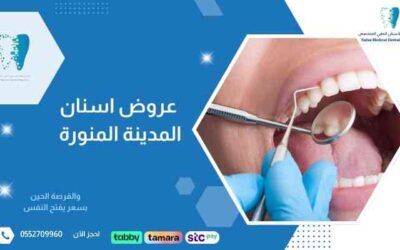 عروض اسنان المدينة المنورة