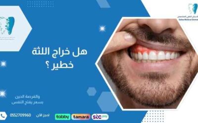 هل خراج اللثة خطير؟