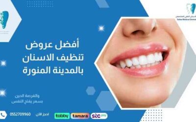 أفضل عروض تنظيف الاسنان بالمدينة المنورة