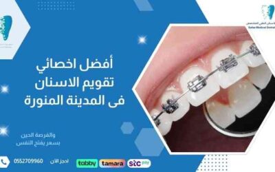 أفضل اخصائي تقويم الاسنان فى المدينة المنورة