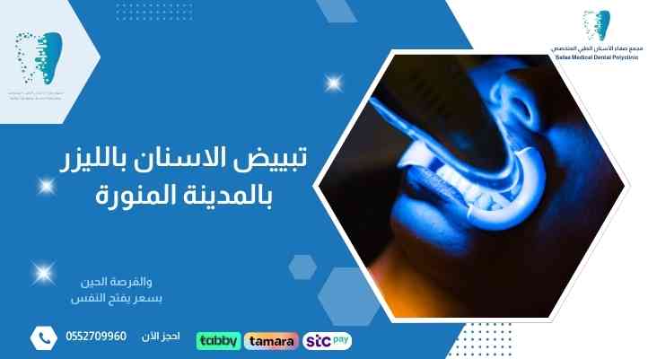 تبييض-الاسنان-بالليزر-بالمدينة-المنورة تبييض-الاسنان-بالليزر-بالمدينة-المنورة