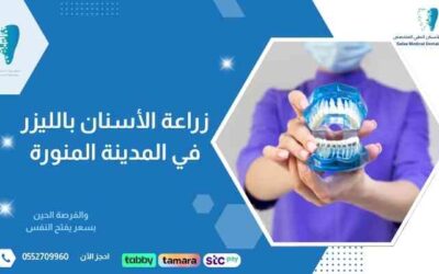 زراعة الأسنان بالليزر في المدينة المنورة