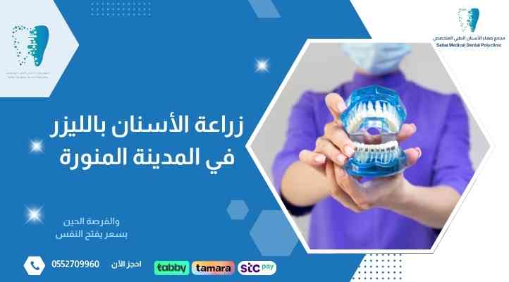 زراعة الأسنان بالليزر في المدينة المنورة