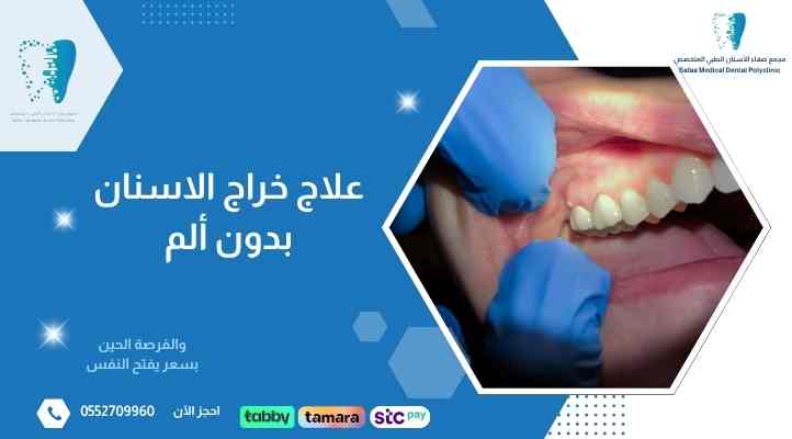 علاج خراج الاسنان بدون ألم
