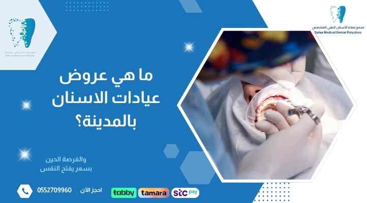 ما هي عروض عيادات الاسنان بالمدينة؟